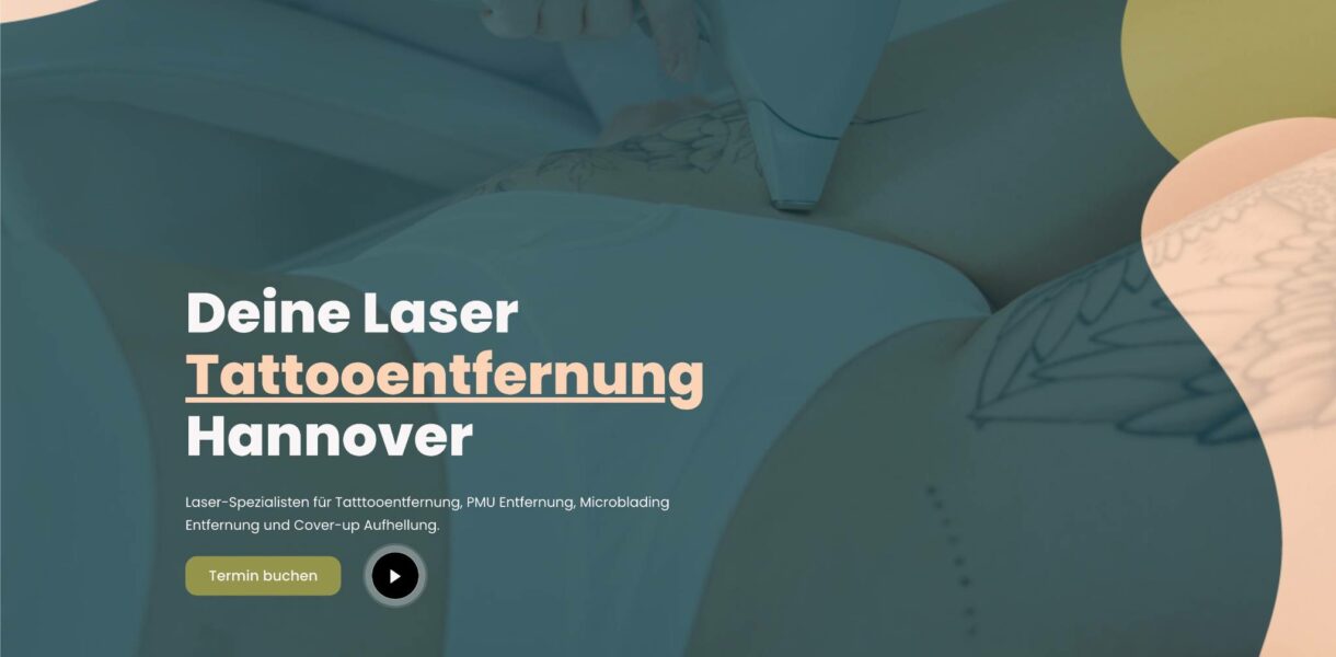 Deine Laser Tattooentfernung Hannover
