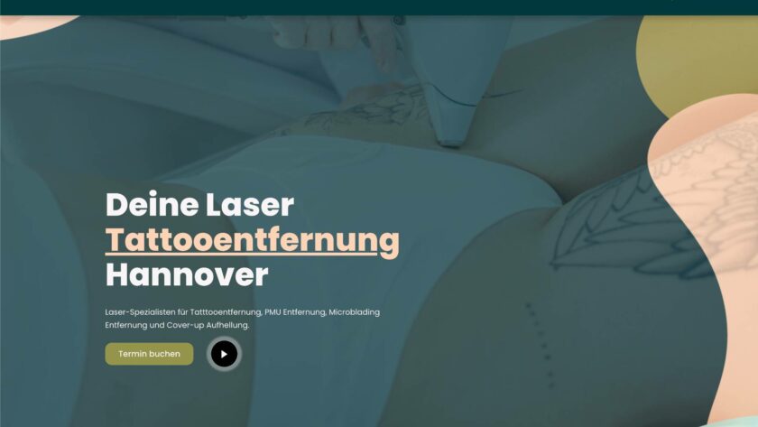 Deine Laser Tattooentfernung Hannover